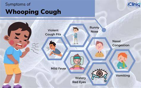 Symptoms Of Whooping Cough