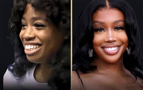 Sza Face Surgery