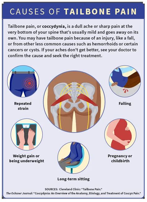 Tailbone Hurts When Sitting