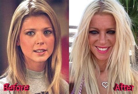 Tara Reid Plastic Surgery Face