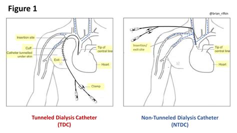 Tdc Medical Abbreviation
