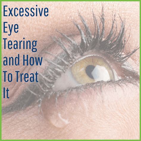 Tearing Eyes Treatment