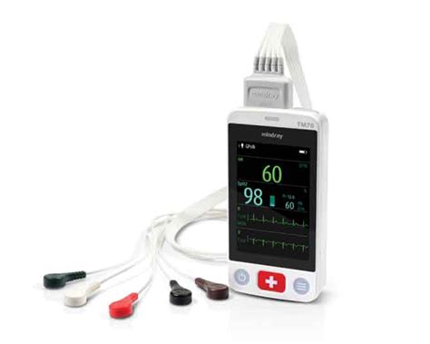 Telemetry Monitor