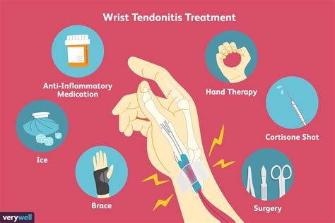 Tendonitis Treatment For Wrist