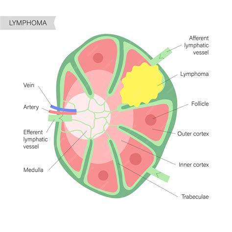 Tests For Lymphoma Cancer