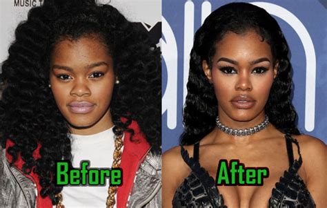 Teyana Taylor Surgery On Face