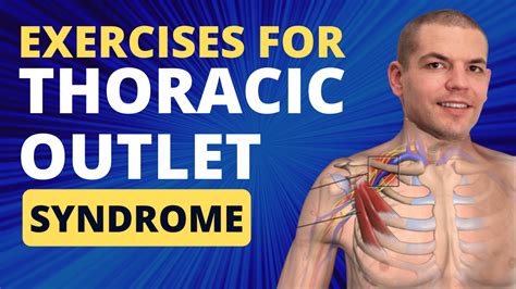 Thoracic Outlet Syndrome Treatments