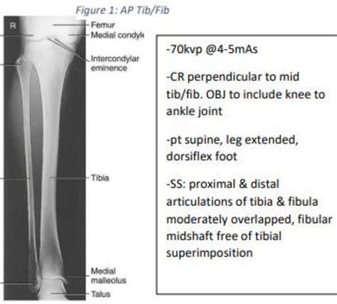 Tib And Fib