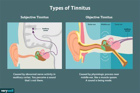 Tinnitus In One Ear