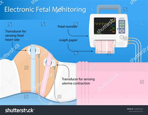 Toco Monitor
