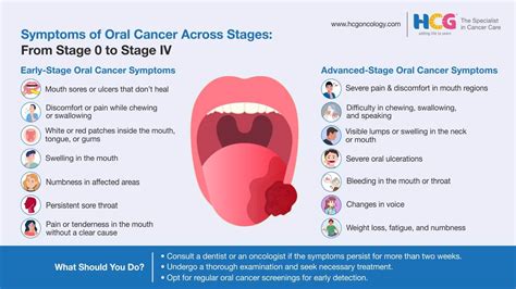 Tongue Cancer Early Stage Symptoms