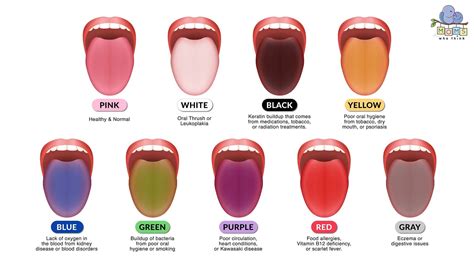 Tongue Color Meaning