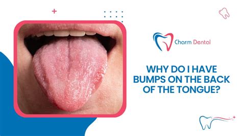Tongue Red Bumps Back