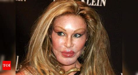 Too Much Plastic Surgery Face
