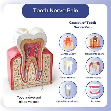 Tooth Nerve Pain Relief