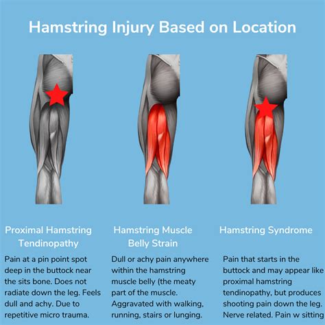 Torn Hamstring Muscle Recovery Time