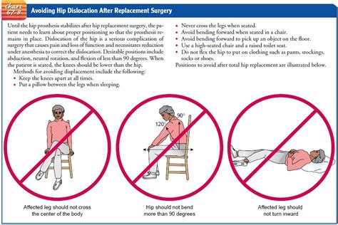 Total Hip Replacement Precautions