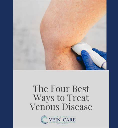 Treat Venous Disease