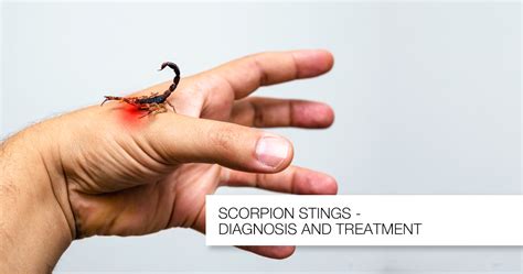Treating A Scorpion Sting