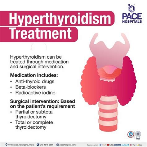Treatment For Hyperthyroidism