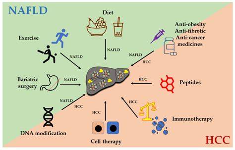 Treatment For Nafld