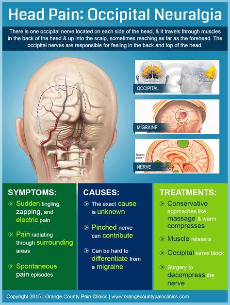 Treatment For Occipital Neuralgia