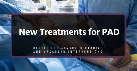 Treatment For Pad