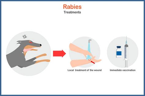 Treatment For Rabies