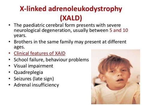 Treatment For Xald