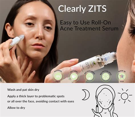 Treatment For Zits
