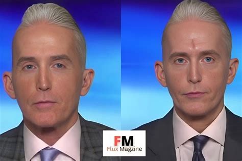Trey Gowdy Face Surgery