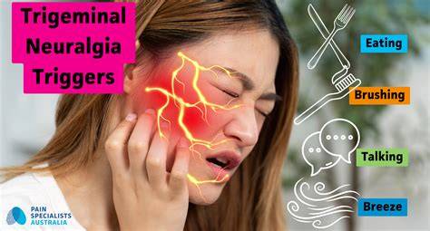 Trigeminal Neuralgia Specialists