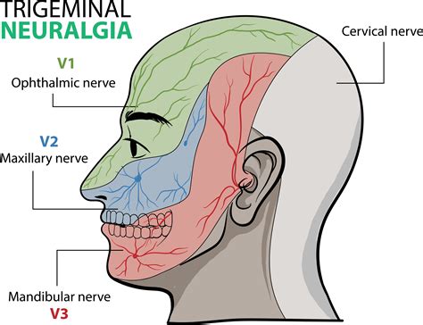 Trigeminal Neuralgia Treatments