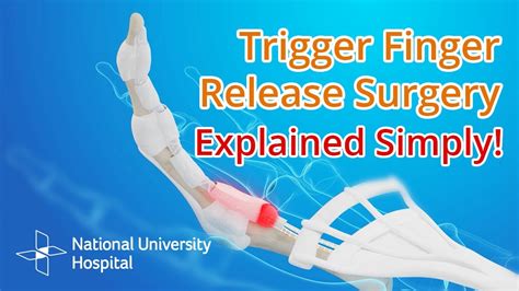 Trigger Finger Surgery