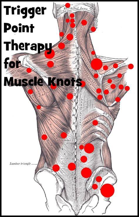 Trigger Point Muscle Therapy