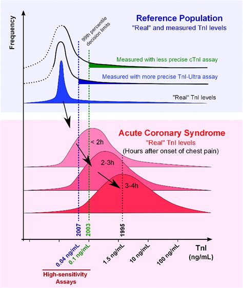 Troponin Levels High