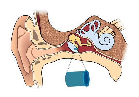 Tubes And Ears