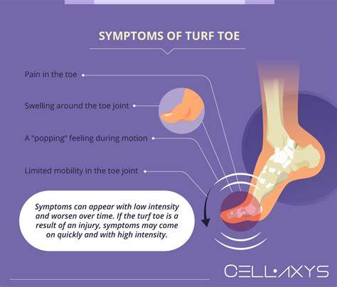 Turf Toe Recovery Time