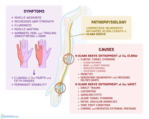 Ulnar Nerve Damage Symptoms