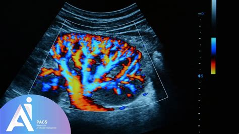 Ultrasound Doppler In Pregnancy