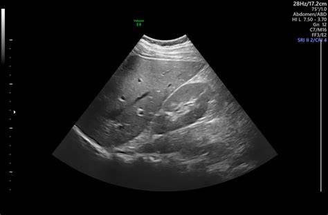 Ultrasound Photo