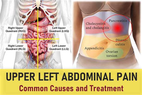 Upper Abdomen Pain