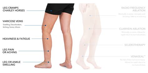 Upper Leg Pain