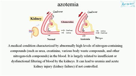 Uraemia Vs Azotaemia