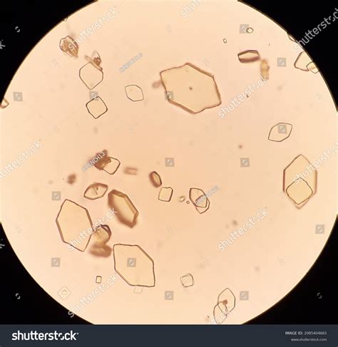 Uric Acid In Urine