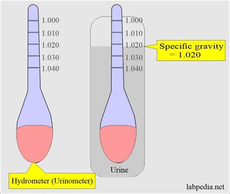 Urinalysis Normal Specific Gravity