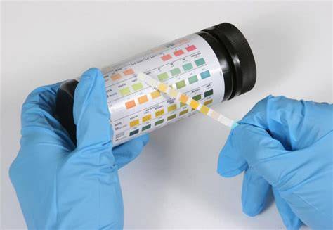 Urine Dipstick Test