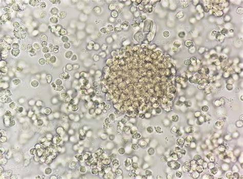 Urine White Blood Cells