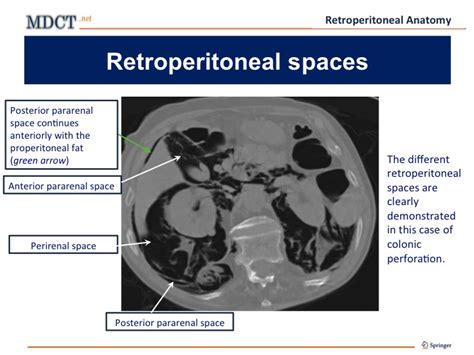 Us Retroperitoneal Complete