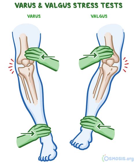 Valgus Stress Test